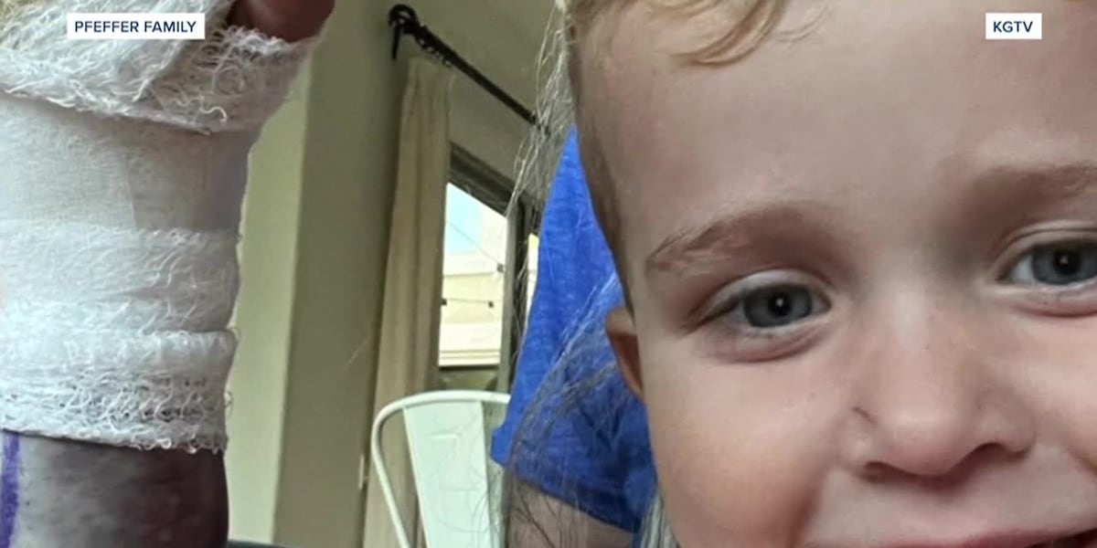 GRAPHIC: Toddler survives rattlesnake bite [Video]