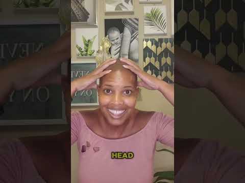 #BaldChronicles [Video]