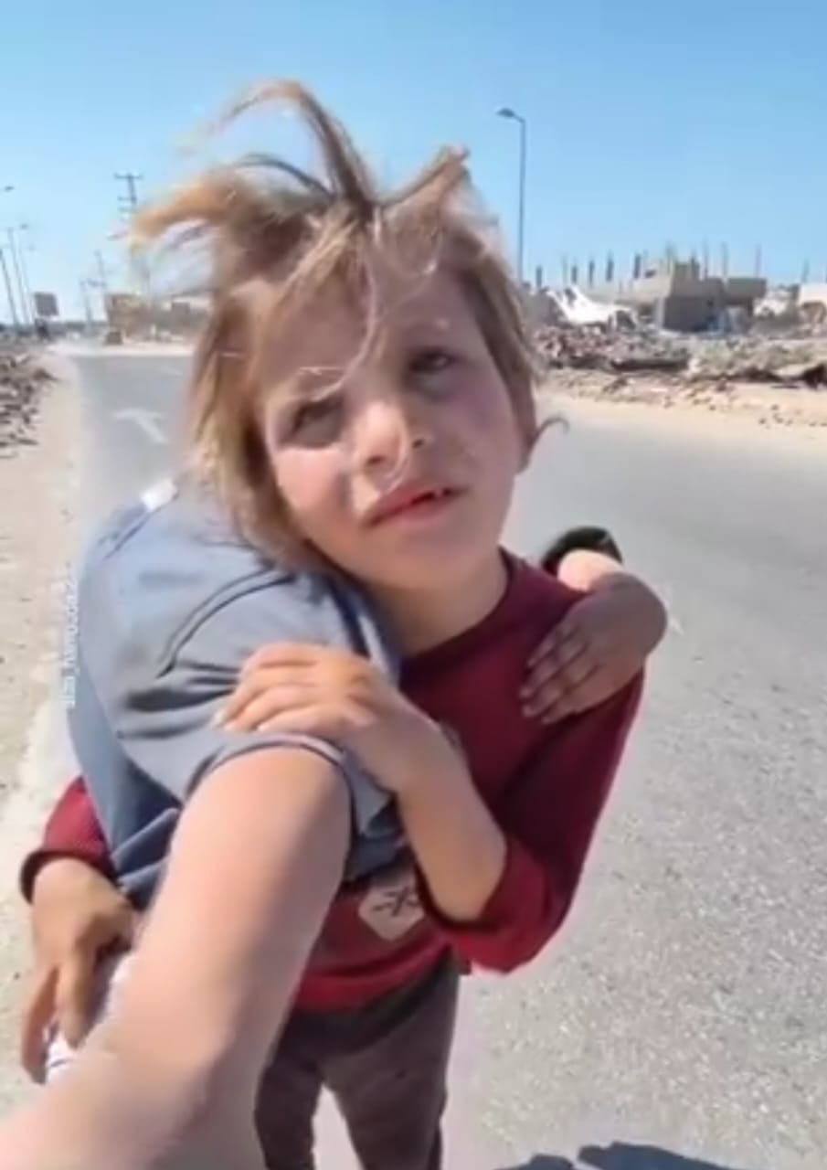 Heroic Act of Young Palestinian Girl Carrying Injured Sister for an Hour in War-Torn Gaza, Touching Hearts in Viral Video